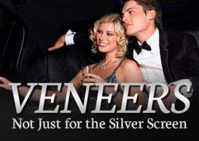 silver screen dental