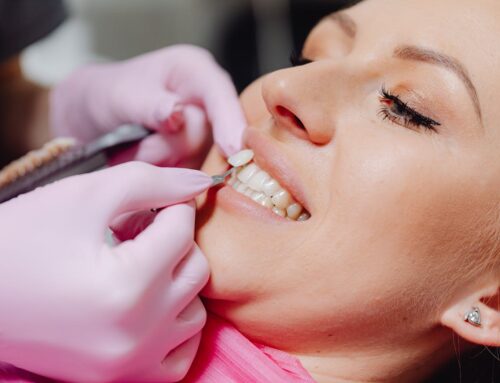 Why Choose Porcelain Veneers Over Traditional Braces: A Helpful Comparison